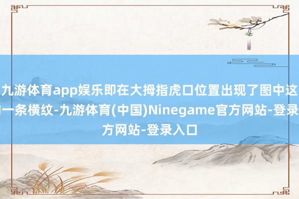 九游体育app娱乐即在大拇指虎口位置出现了图中这么的一条横纹-九游体育(中国)Ninegame官方网站-登录入口